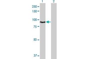 Western Blot analysis of TNNI3K expression in transfected 293T cell line by TNNI3K MaxPab polyclonal antibody. (TNNI3K antibody  (AA 1-843))
