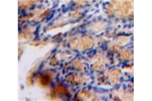 Used in DAB staining on fromalin fixed paraffin-embedded Bowels tissue (TGFB1I1 antibody  (AA 256-461))