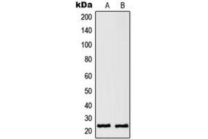 Western blot analysis of RAN expression in HeLa (A), A431 (B) whole cell lysates.
