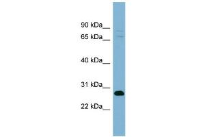 WB Suggested Anti-TMEM176A Antibody Titration:  0. (TMEM176A antibody  (Middle Region))