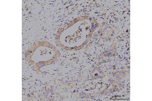 IHC analysis of KCNQ1 using anti-KCNQ1 antibody (ABIN4886647).
