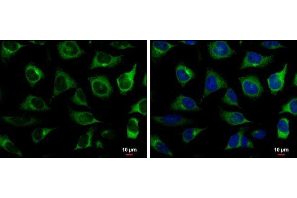 RRM2 antibody  (Regulatory Subunit)
