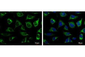 ICC/IF Image RRM2 antibody [N1C1] detects RRM2 protein at cytoplasm by immunofluorescent analysis.