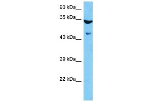 Host:  Mouse  Target Name:  ESRRG  Sample Tissue:  Mouse Brain  Antibody Dilution:  1ug/ml (ESRRG antibody  (Middle Region))