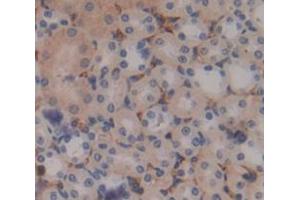 Figure. (SPON1 antibody  (AA 195-392))