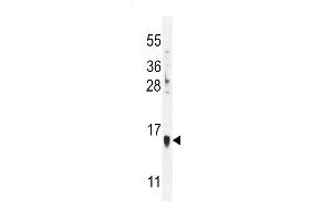 RT-1/Melan-A Antibody (Center) (ABIN655635 and ABIN2845114) western blot analysis in HL-60 cell line lysates (35 μg/lane). (MLANA antibody  (AA 34-60))