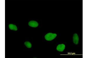 Immunofluorescence of purified MaxPab antibody to FLJ10826 on HeLa cell.