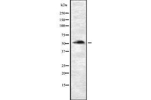 Western blot analysis of P4HTM using Jurkat whole cell lysates (P4HTM antibody  (Internal Region))