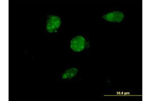 Immunofluorescence of monoclonal antibody to TSC22D4 on HeLa cell. (TSC22D4 antibody  (AA 1-395))