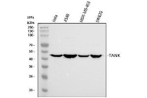 Western blot analysis of TANK using anti-TANK antibody (ABIN6719508). (TANK antibody)