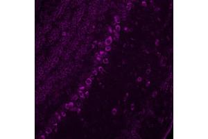 Immunohistochemistry (IHC) image for anti-Corticotropin Releasing Hormone (CRH) antibody (ABIN7456343) (CRH antibody)