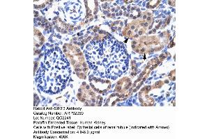Human kidney (SIRT3 antibody  (C-Term))