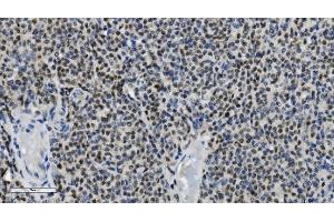 IHC analysis of PARP using anti-PARP antibody (ABIN7602278). (PARP1 antibody  (AA 670-858))
