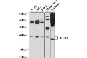 Western blot analysis of extracts of various cell lines, using MESP1 antibody (ABIN6131056, ABIN6143747, ABIN6143748 and ABIN6214298) at 1:1000 dilution. (MESP1 antibody  (AA 149-268))