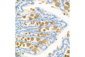 Immunohistochemistry of paraffin embedded mouse colon using CNTROB (ABIN7073427) at dilution of 1:200 (400x lens) (CNTROB antibody)