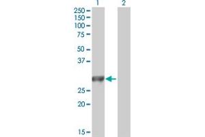 Western Blot analysis of MYO3A expression in transfected 293T cell line by MYO3A MaxPab polyclonal antibody. (MYO3A antibody  (AA 1-247))