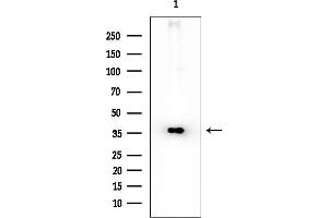 anti-Serine Racemase (SRR) (Internal Region) antibody