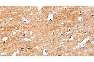 Immunohistochemistry of paraffin-embedded Human brain tissue using S100B Polyclonal Antibody at dilution 1:50 (S100B antibody)
