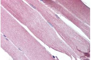 Human Skeletal Muscle (formalin-fixed, paraffin-embedded) stained with CHRND antibody ABIN213757 at 5 ug/ml followed by biotinylated goat anti-rabbit IgG secondary antibody ABIN481713, alkaline phosphatase-streptavidin and chromogen. (CHRND antibody  (N-Term))