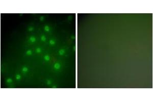 Immunofluorescence analysis of HepG2 cells, using HDAC9 Antibody. (HDAC9 antibody  (AA 1017-1066))