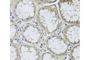 Immunohistochemistry of paraffin-embedded Human stomach using BCL2L2 Polyclonal Antibody at dilution of 1:100 (40x lens). (BCL2L2 antibody)