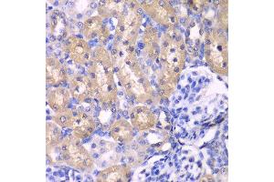 Immunohistochemistry (IHC) image for anti-Ribosomal Protein S6 Kinase, 70kDa, Polypeptide 1 (RPS6KB1) (AA 1-352) antibody (ABIN3023169) (RPS6KB1 antibody  (AA 1-352))