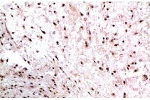 Immunohistochemistry of paraffin-embedded Human colon carcinoma tissue using CBX3 Monoclonal Antibody at dilution of 1:200. (CBX3 antibody)