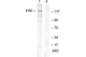 Western blot analysis of extracts from HeLa cells, treated with EGF 200ng/ml 30', using FAK (Ab-407) Antibody. (FAK antibody  (AA 373-422))