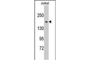 Western blot analysis of EPRS polyclonal antibody  in Jurkat cell line lysates (35 ug/lane). (EPRS antibody  (N-Term))