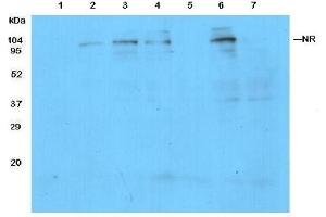 Detection of NR in protein extracts from leaves of Columbia (1) and NR knockout(2-3) mutants of Arabidopsis thaliana. (Nitrate Reductase antibody)