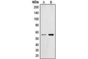 Western blot analysis of ZNF187 expression in HL60 (A), SP2/0 (B) whole cell lysates. (ZNF187 antibody  (Center))