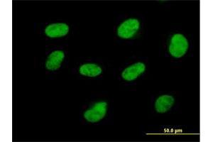 Immunofluorescence of purified MaxPab antibody to CDK7 on HeLa cell. (CDK7 antibody  (AA 1-346))