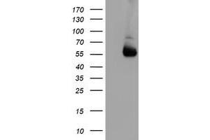 HEK293T cells were transfected with the pCMV6-ENTRY control (Left lane) or pCMV6-ENTRY ALG2 (Right lane) cDNA for 48 hrs and lysed. (ALG2 antibody)