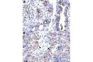 Immunohistochemical staining (Formalin-fixed paraffin-embedded sections) of human lung (A) and human liver (B) with HTATIP2 polyclonal antibody  at 4-8 ug/mL working concentration. (HIV-1 Tat Interactive Protein 2, 30kDa (HTATIP2) (N-Term) antibody)