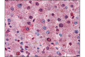 AP22624PU-N AKT antibody staining of Formalin-Fixed Paraffin-Embedded Human Liver at 1/100 followed by Biotin conjugated Goat anti-Rabbit IgG secondary antibody, Alkaline Phosphatase-Streptavidin and Chromogen. (AKT1 antibody  (C-Term))
