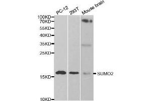 Western blot analysis of extracts of various cell lines, using SUMO2 antibody. (SUMO2 antibody  (AA 1-95))