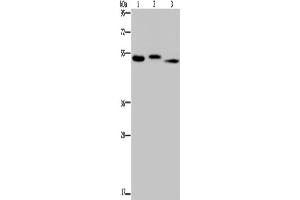 Western Blotting (WB) image for anti-Hyaluronidase-3 (HYAL3) antibody (ABIN2423631) (HYAL3 antibody)