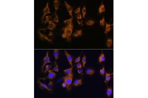 Immunofluorescence analysis of C6 using SPRR3 antibody (ABIN6130714, ABIN6148386, ABIN6148387 and ABIN6215609) at dilution of 1:100 (40x lens). (SPRR3 antibody  (AA 1-70))