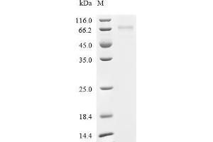Tumor Protein P53 (TP53) (AA 1-393), (full length) protein (His tag)