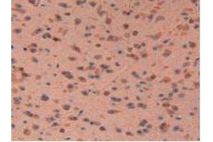 IHC-P analysis of Mouse Brain Tissue, with DAB staining. (LIFR antibody  (AA 381-485))