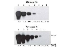 Two similar blots were processed with the same procedures using different ONE-HOUR WesternTM Kits: Standard (ABIN491508) and Advanced (ABIN491500). (ONE-HOUR Western Basic Kit (Mouse))