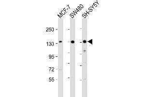 All lanes : Anti-SRG Antibody (C-term) at 1:2000 dilution Lane 1: MCF-7 whole cell lysate Lane 2: S whole cell lysate Lane 3: SH-SY5Y whole cell lysate Lysates/proteins at 20 μg per lane. (SRGAP2 antibody  (C-Term))