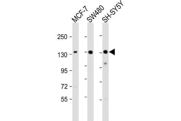 SRGAP2 anticorps  (C-Term)