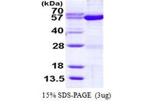 SDS-PAGE (SDS) image for Seryl-tRNA Synthetase (SARS) (AA 1-514) protein (His tag) (ABIN667644) (Seryl-tRNA Synthetase (SARS) (AA 1-514) protein (His tag))