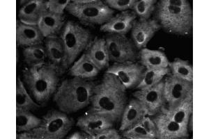 Immunofluorescent staining of A549 (ATCC CCL-185) cells. (GNB2L1 antibody  (AA 113-317))