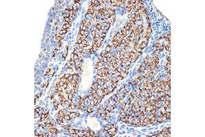 Immunohistochemistry of paraffin-embedded rat ovary using HSD3B1 Rabbit mAb (ABIN7267801) at dilution of 1:100 (40x lens). (HSD3B1 antibody)