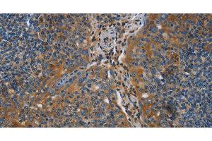 Immunohistochemistry of paraffin-embedded Human tonsil using NRN1 Polyclonal Antibody at dilution of 1:40