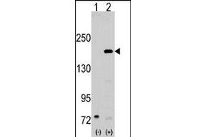 Western blot analysis of SRC1 (arrow) using rabbit NCOA1 polyclonal antibody . (NCOA1 antibody  (N-Term))