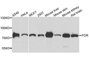 Western blot analysis of extracts of various cell lines, using POR antibody. (POR antibody  (AA 1-250))