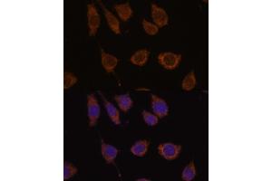 Immunofluorescence analysis of L929 cells using CB antibody (ABIN7266072) at dilution of 1:100. (CA5B antibody  (AA 1-317))